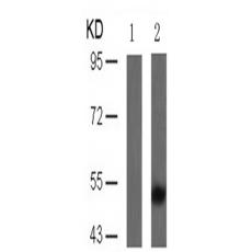 兔抗MAPT (Phospho-Thr205)多克隆抗体