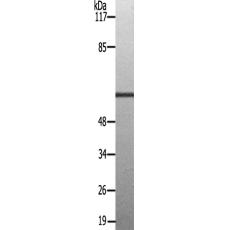 兔抗PAK2(Ab-192)多克隆抗体