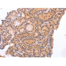 兔抗NR3C1多克隆抗体