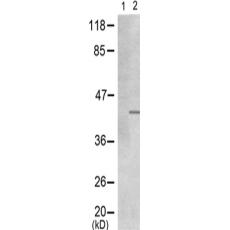 兔抗MYOD1 (Phospho-Ser200)多克隆抗体