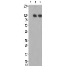 兔抗TNK2(Ab-284)多克隆抗体