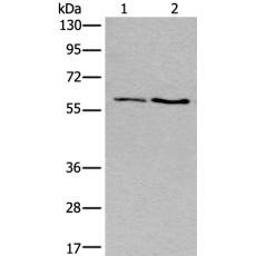 兔抗SLC17A8多克隆抗体