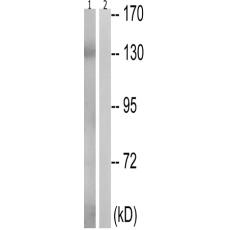 兔抗NOS3(Phospho-Thr494)多克隆抗体