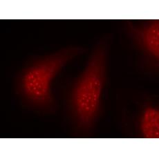 兔抗RPS6KA1 (Phospho-Thr348)多克隆抗体