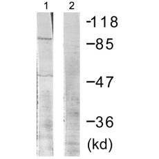  兔抗RPS6KA1(Phospho-Thr573) 多克隆抗体