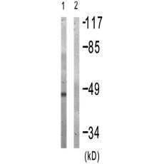 兔抗PRKAR2B(Phospho-Ser113)多克隆抗体  