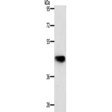 兔抗NKX2-1多克隆抗体