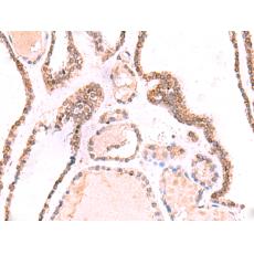 兔抗TOR1AIP1多克隆抗体