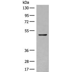 兔抗SERPINA9多克隆抗体