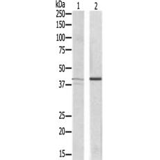 兔抗NKX2-4多克隆抗体 
