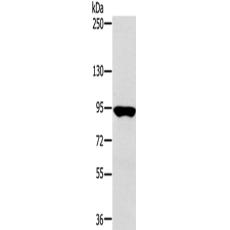 兔抗RNF214多克隆抗体