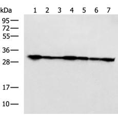 兔抗PSMA1多克隆抗体