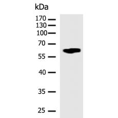 兔抗STK34(Phospho-Thr183)多克隆抗体