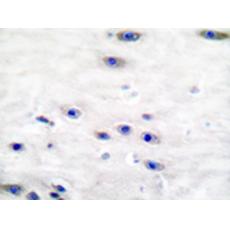 兔抗TH(Ab-19)多克隆抗体