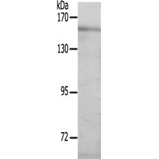 兔抗PLCG1(Ab-771)多克隆抗体