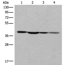 兔抗ROM1多克隆抗体