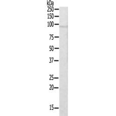 兔抗MCPH1多克隆抗体