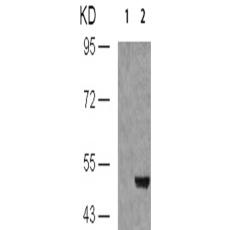 兔抗MAPT (Phospho-Thr231)多克隆抗体