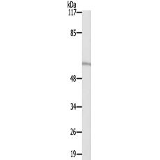 兔抗RIOK3多克隆抗体