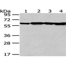 兔抗PKM多克隆抗体