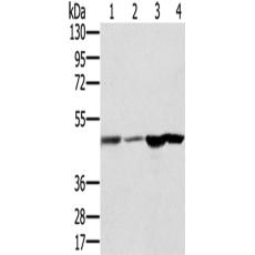 兔抗RNH1多克隆抗体   
