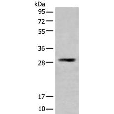 兔抗TMEM192多克隆抗体