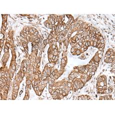 兔抗RNF111多克隆抗体   