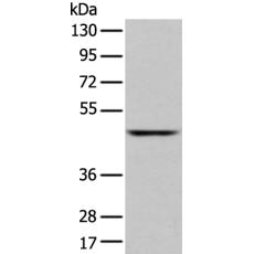 兔抗SLC2A6多克隆抗体   