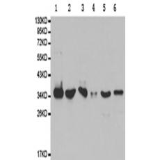 兔抗PPP4C多克隆抗体