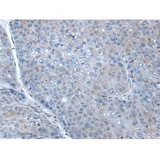 兔抗SCGB3A1多克隆抗体 