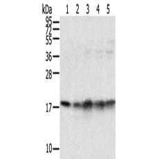 兔抗TAF11多克隆抗体
