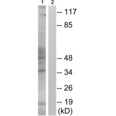 兔抗MAPKAPK2(Phospho-Ser272)多克隆抗体