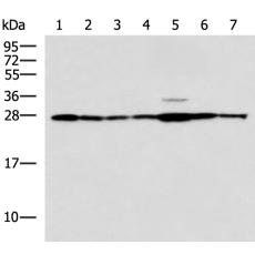 兔抗RPL10A多克隆抗体    