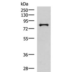 兔抗PRPF3多克隆抗体