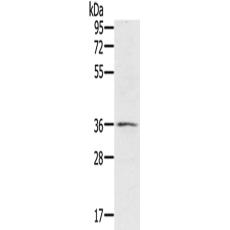 兔抗RNF144B多克隆抗体 