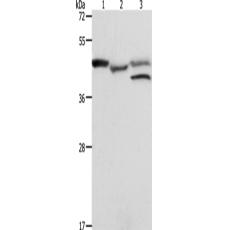 兔抗PSMD6多克隆抗体