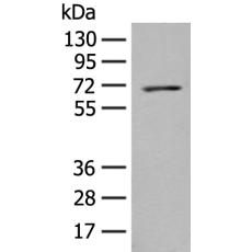 兔抗PPM1D多克隆抗体