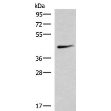  兔抗SMPD2多克隆抗体 