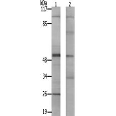 兔抗PRKAR2B(Ab-113)多克隆抗体