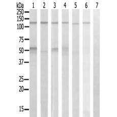兔抗PPFIBP1多克隆抗体