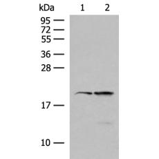 兔抗RNF5多克隆抗体 