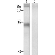 兔抗PRKCA(Phospho-Tyr657)多克隆抗体