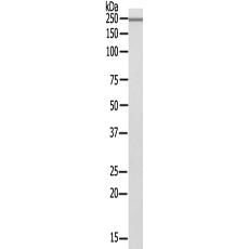 兔抗PTPRZ1多克隆抗体