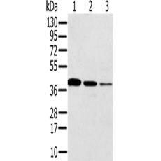 兔抗SYCP3多克隆抗体
