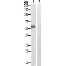 兔抗SLC16A2多克隆抗体