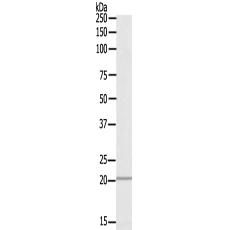 兔抗RASL10B多克隆抗体  