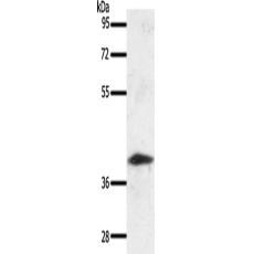 兔抗SSTR2多克隆抗体