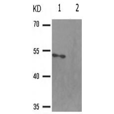 兔抗TP53(Phospho-Ser392)多克隆抗体