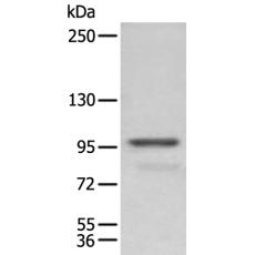 兔抗PDCD6IP多克隆抗体