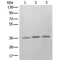 兔抗RBM11多克隆抗体   